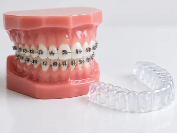 Illustrative image: orthodontics